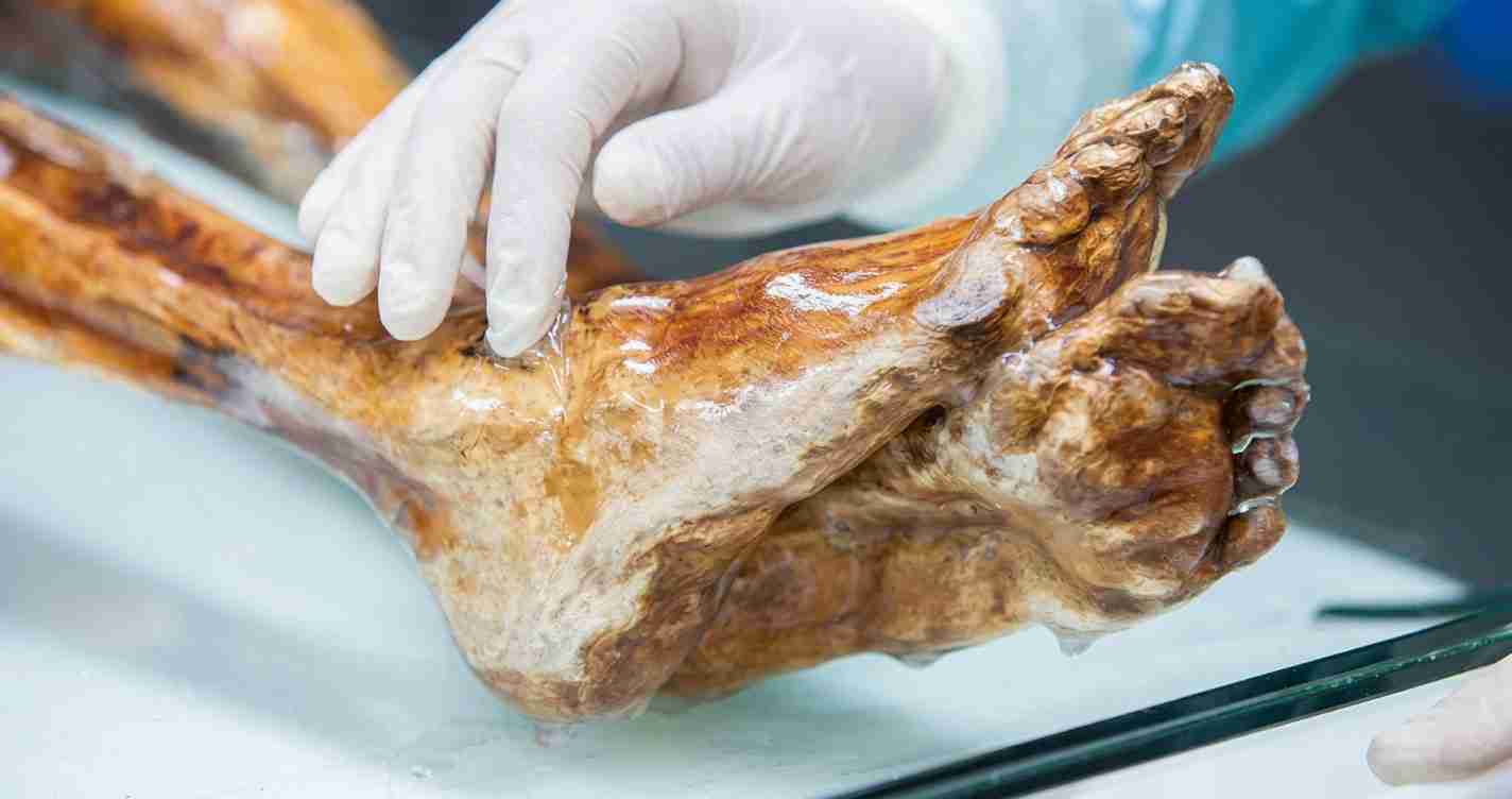 Gloved hands handle a large, brownish foot specimen on a sterile tray in a medical or lab setting.
