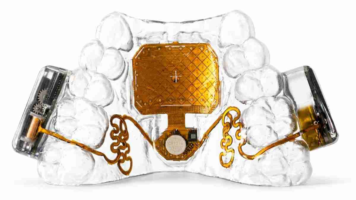 Transparent dental jaw model displaying a gold-colored implant prosthesis with circuit-like wiring and side components for demonstration purposes.
